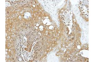 IHC-P Image Immunohistochemical analysis of paraffin-embedded Cal27 xenograft, using EIF3K, antibody at 1:100 dilution. (EIF3K antibody)