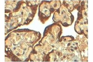 Image no. 3 for anti-Plasminogen Activator Inhibitor 1 (SERPINE1) (Internal Region) antibody (ABIN374547) (PAI1 antibody  (Internal Region))