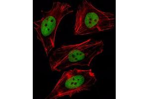 Immunofluorescence (IF) image for anti-Forkhead Box D1 (FOXD1) antibody (ABIN2997954) (FOXD1 antibody)