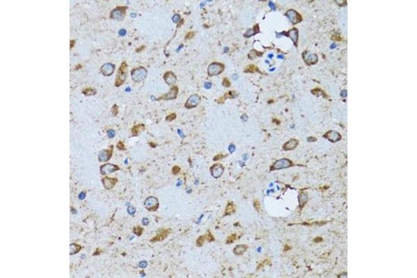 PDP antibody  (AA 278-537)