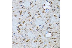 Immunohistochemistry of paraffin-embedded mouse brain using PDP1 antibody (ABIN6132860, ABIN6145404, ABIN6145405 and ABIN6221944) at dilution of 1:100 (40x lens). (PDP antibody  (AA 278-537))