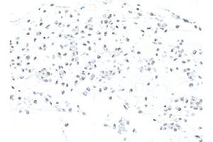 Immunocytochemistry (ICC) image for anti-Mismatch Repair Protein 2 (MSH2) (AA 625-675) antibody (ABIN7453978) (Recombinant MSH2 antibody  (AA 625-675))