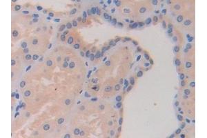 Immunohistochemistry (IHC) image for anti-Histone Deacetylase 6 (HDAC6) (AA 166-348) antibody (ABIN7435907)