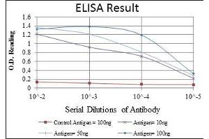 Red: Control Antigen (100 ng), Purple: Antigen (10 ng), Green: Antigen (50 ng), Blue: Antigen (100 ng), (CCT2 antibody)
