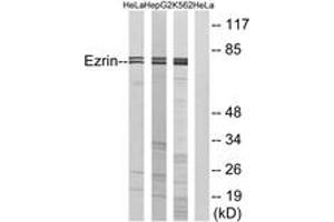 Western blot analysis of extracts from HeLa/HepG2/K562, using Ezrin (Ab-566) Antibody. (Ezrin antibody  (AA 534-583))