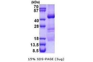 Figure annotation denotes ug of protein loaded and % gel used. (XPA Protein)