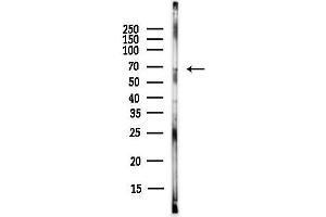 Western blot analysis of lysates from EC304 cells(heat-shock,45 min treatment), using YY1 Antibody at 1/1000 dilution.