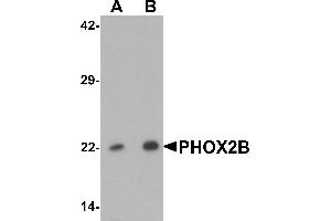 Western blot analysis of PHOX2B in 293 cell lysate with PHOX2B antibody at (A) 1 and (B) 2 µg/mL. (PHOX2B antibody  (Middle Region))