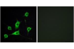 Immunofluorescence analysis of LOVO cells, using CRBP III Antibody. (Retinol Binding Protein 5 antibody  (AA 10-59))