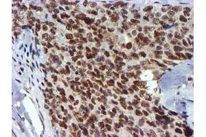 Image no. 10 for anti-Ubiquitin Specific Peptidase 7 (Herpes Virus-Associated) (USP7) antibody (ABIN1498592) (USP7 antibody)