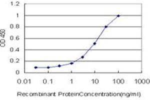 Detection limit for recombinant GST tagged PHF21A is approximately 0. (PHF21A antibody  (AA 331-430))