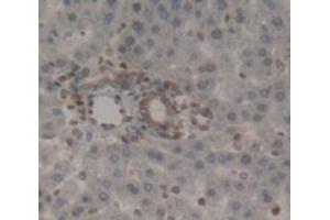 Immunohistochemistry (IHC) image for anti-Polymeric Immunoglobulin Receptor (PIGR) (AA 135-237) antibody (ABIN1174192)