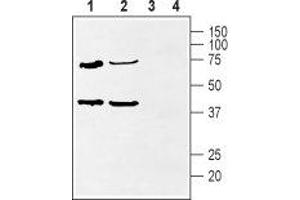 Western blot analysis of rat heart (lanes 1 and 3) and rat hippocampus (lanes 2 and 4) lysate: - 1,2. (KCNIP2 antibody  (Cytosolic, N-Term))