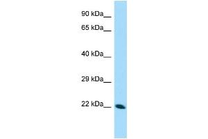 WB Suggested Anti-CDNF Antibody Titration: 1.