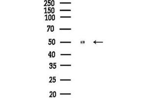 anti-Dihydrouridine Synthase 2-Like (DUS2L) (C-Term) antibody
