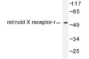 Image no. 1 for anti-Retinoid X Receptor, gamma (RXRG) antibody (ABIN271807) (Retinoid X Receptor gamma antibody)