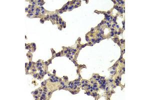 Immunohistochemistry of paraffin-embedded Rat lung using HDAC7 antibody at dilution of 1:100 (x400 lens). (HDAC7 antibody)