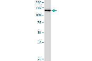 CHERP MaxPab polyclonal antibody. (CHERP antibody  (AA 1-884))