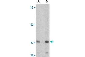 Western blot analysis of FBXL20 in A-20 cell lysate with FBXL20 polyclonal antibody  at (A) 0. (FBXL20 antibody  (N-Term))