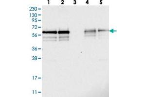 Western blot analysis of Lane 1: RT-4, Lane 2: U-251 MG, Lane 3: Human Plasma, Lane 4: Liver, Lane 5: Tonsil with BSDC1 polyclonal antibody  at 1:250-1:500 dilution. (BSDC1 antibody)