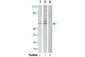 Western blot analysis of extracts from HepG2 cells (Lane 1 and 3) and 293 cells (Lane 2), using DAB1 polyclonal antibody . (DAB1 antibody)