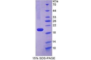 SDS-PAGE analysis of Human Fibulin 5 Protein.