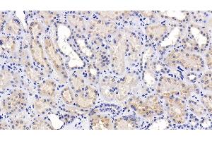 Immunohistochemistry (IHC) image for anti-Lysosomal-Associated Membrane Protein 2 (LAMP2) (AA 193-375) antibody (ABIN7438691)