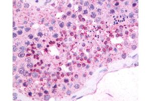 Anti-NMBR antibody IHC of human testis. (NMBR antibody  (Cytoplasmic Domain))