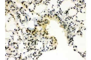IHC testing of FFPE mouse lung wtih SP3 antibody.