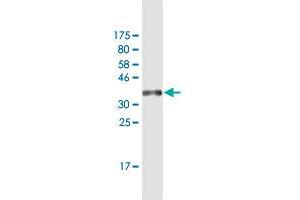 Western Blot detection against Immunogen (36. (ZNF10 antibody  (AA 1-98))