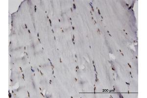 Immunoperoxidase of monoclonal antibody to RCSD1 on formalin-fixed paraffin-embedded human skeletal muscle. (RCSD1 antibody  (AA 181-289))