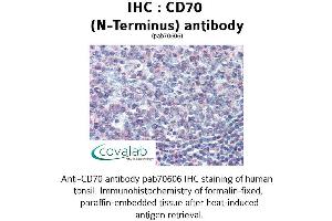 Image no. 1 for anti-CD70 Molecule (CD70) (N-Term) antibody (ABIN1732877) (CD70 antibody  (N-Term))