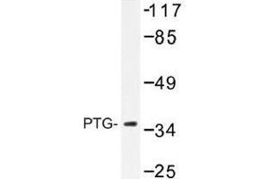 Image no. 1 for anti-Protein Phosphatase 1, Regulatory Subunit 3C (PPP1R3C) antibody (ABIN317934) (PPP1R3C antibody)