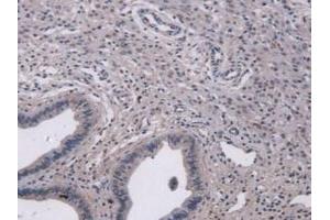 IHC-P analysis of Mouse Uterus Tissue, with DAB staining. (MUC5B antibody  (AA 75-295))