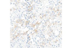 Immunohistochemistry (IHC) image for anti-Mast/stem Cell Growth Factor Receptor (KIT) (AA 325-375) antibody (ABIN7795658) (Recombinant KIT antibody  (AA 325-375))