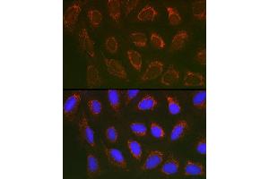 Immunofluorescence analysis of U2OS cells using SLC25 Rabbit pAb (ABIN1682768, ABIN3017839, ABIN3017840 and ABIN6220286) at dilution of 1:100 (40x lens). (SLC25A6 antibody  (AA 1-298))