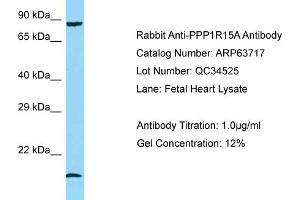 Western Blotting (WB) image for anti-Protein Phosphatase 1, Regulatory (Inhibitor) Subunit 15A (PPP1R15A) (N-Term) antibody (ABIN2789598)