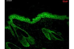 Immunohistochemistry analysis using Mouse Anti-Hsp90 Monoclonal Antibody, Clone H9010 (ABIN361717 and ABIN361718).