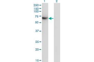 Western Blot analysis of TFCP2 expression in transfected 293T cell line by TFCP2 monoclonal antibody (M01), clone 3H6. (TFCP2 antibody  (AA 414-502))