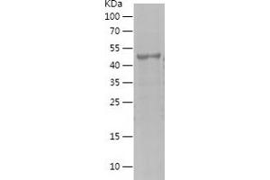 Western Blotting (WB) image for Melanoma Antigen Family A, 1 (Directs Expression of Antigen MZ2-E) (MAGEA1) (AA 161-309) protein (His-IF2DI Tag) (ABIN7123882) (MAGEA1 Protein (AA 161-309) (His-IF2DI Tag))