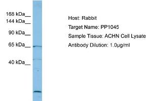 Host: Rabbit Target Name: PP1045 Sample Type: ACHN Whole Cell lysates Antibody Dilution: 1. (PP1045 (C-Term) antibody)