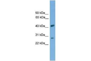 Human THP-1; WB Suggested Anti-SLC25A37 Antibody Titration: 0.