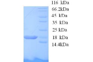 SDS-PAGE (SDS) image for BolA-like Protein 1 (BOLA1) (AA 1-137), (full length) protein (His tag) (ABIN5713286)