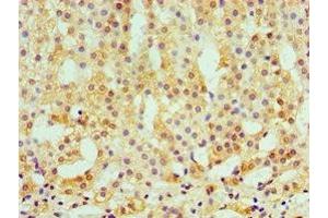Immunohistochemistry of paraffin-embedded human adrenal gland tissue using ABIN7146438 at dilution of 1:100 (CAMK1G antibody  (AA 217-476))