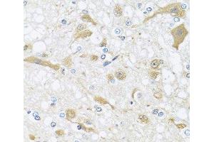 Immunohistochemistry of paraffin-embedded Rat brain using APOL1 Polyclonal Antibody at dilution of 1:100 (40x lens). (APOL1 antibody)