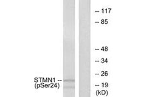 Western blot analysis of extracts from Jurkat cells treated with PMA 1ng/ml 15', using Stathmin 1 (Phospho-Ser24) Antibody. (Stathmin 1 antibody  (pSer25))