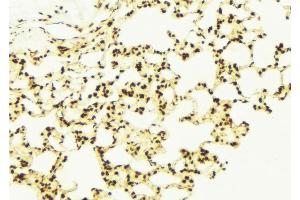 ABIN6273098 at 1/100 staining Mouse lung tissue by IHC-P. (CHCHD3 antibody  (N-Term))