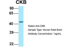 Host: Rabbit  Target Name: CKB  Sample Tissue: Human Fetal Brain  Antibody Dilution: 1. (CKB antibody  (C-Term))