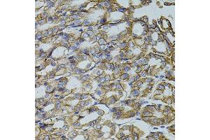 Immunohistochemistry of paraffin-embedded mouse stomach using TRMT2A antibody. (TRMT2A antibody  (C-Term))