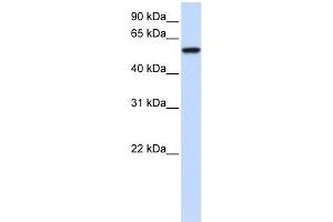 WB Suggested Anti-ZNF675 Antibody Titration: 0.